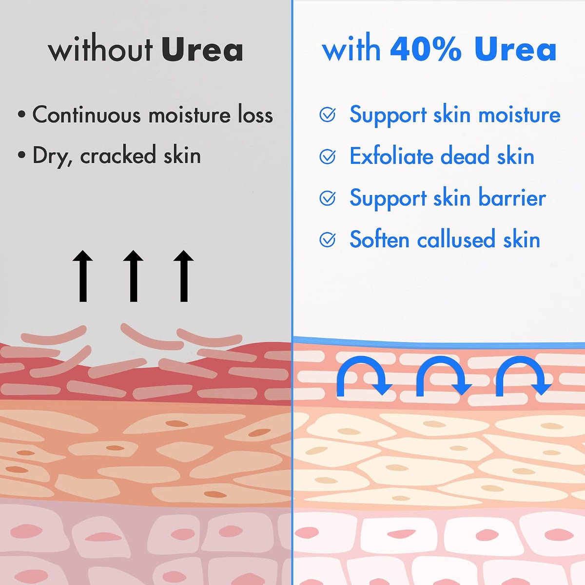 Ebanel Urea Cream 40% plus Salicylic Acid 2% for Dry Cracked Feet Skin
