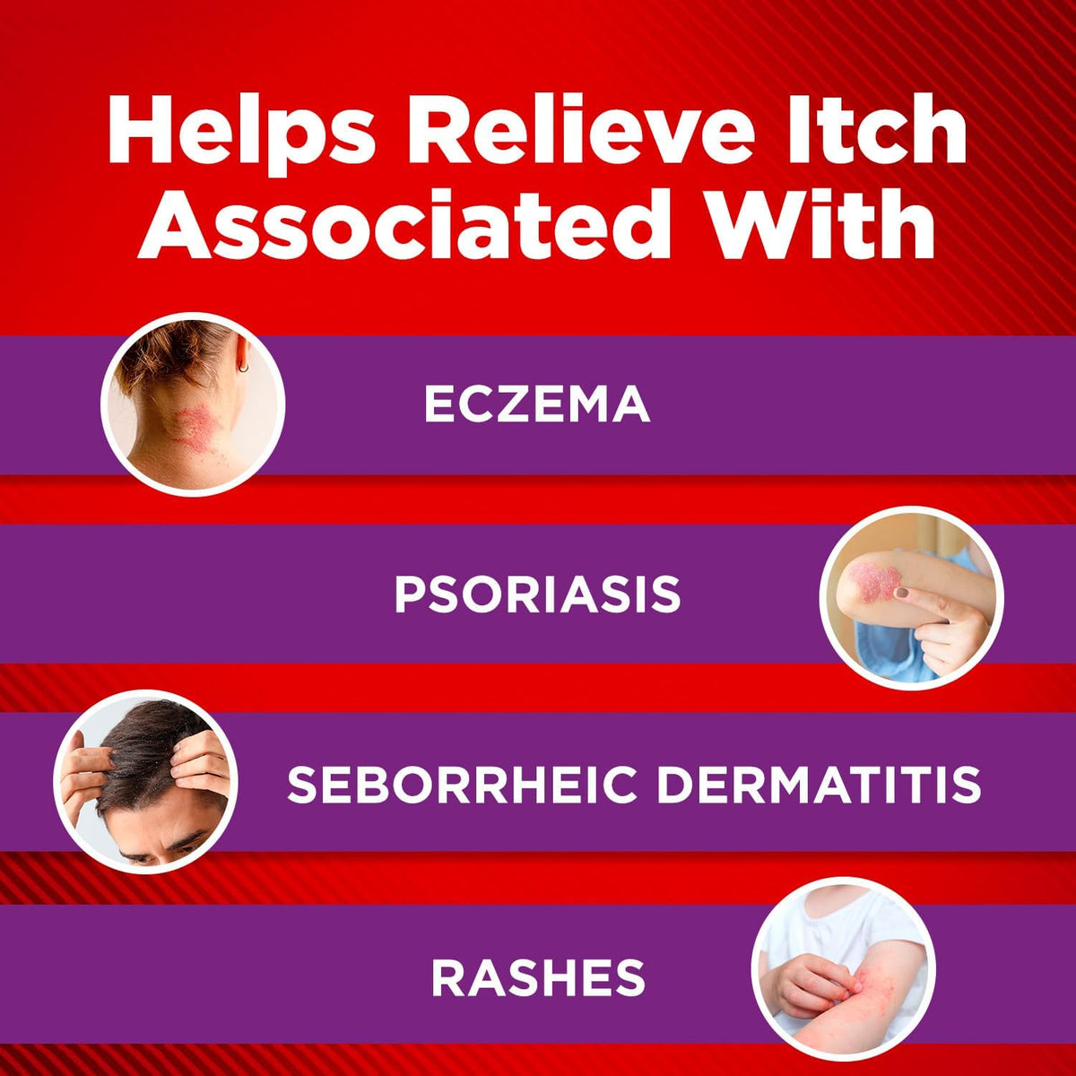 Cortizone-10 Max Strength Healing Itch Relief Eczema Lotion, 3.5 oz.